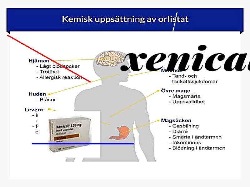 Acheter xenical andorre